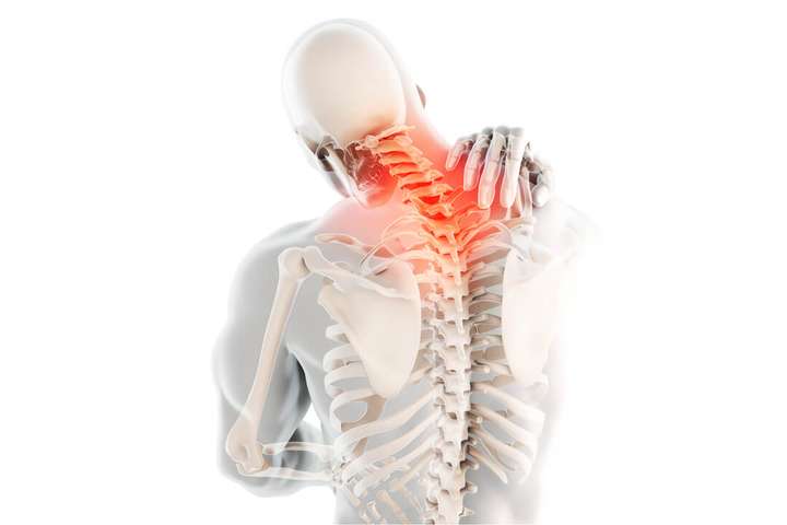 علاج الام الرقبه